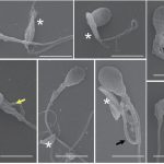 5分钟就能“斩首”人类精子，这种藏在猫砂中的寄生虫可能已感染全球一半人口
