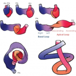 男子心脏中长出“回旋镖”骨，医生却发现很多人都有，且预示着这种危险疾病
